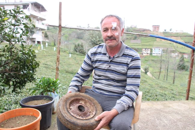 El arabası Lastiği bir gözünü kaybettirdi